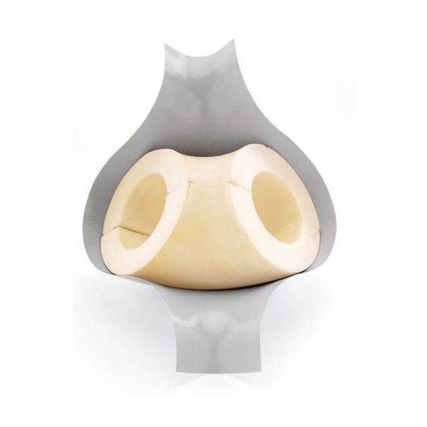 Kolano z poliuretanu 78/30 STEINONORM